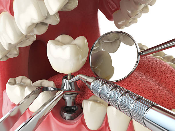 Best Emergency Dentist for Knocked-Out Tooth in , ME